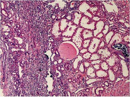 “芯片上的肾小球”功能可媲美真正肾脏 “芯片上的肾小球”功能可媲美真正肾脏